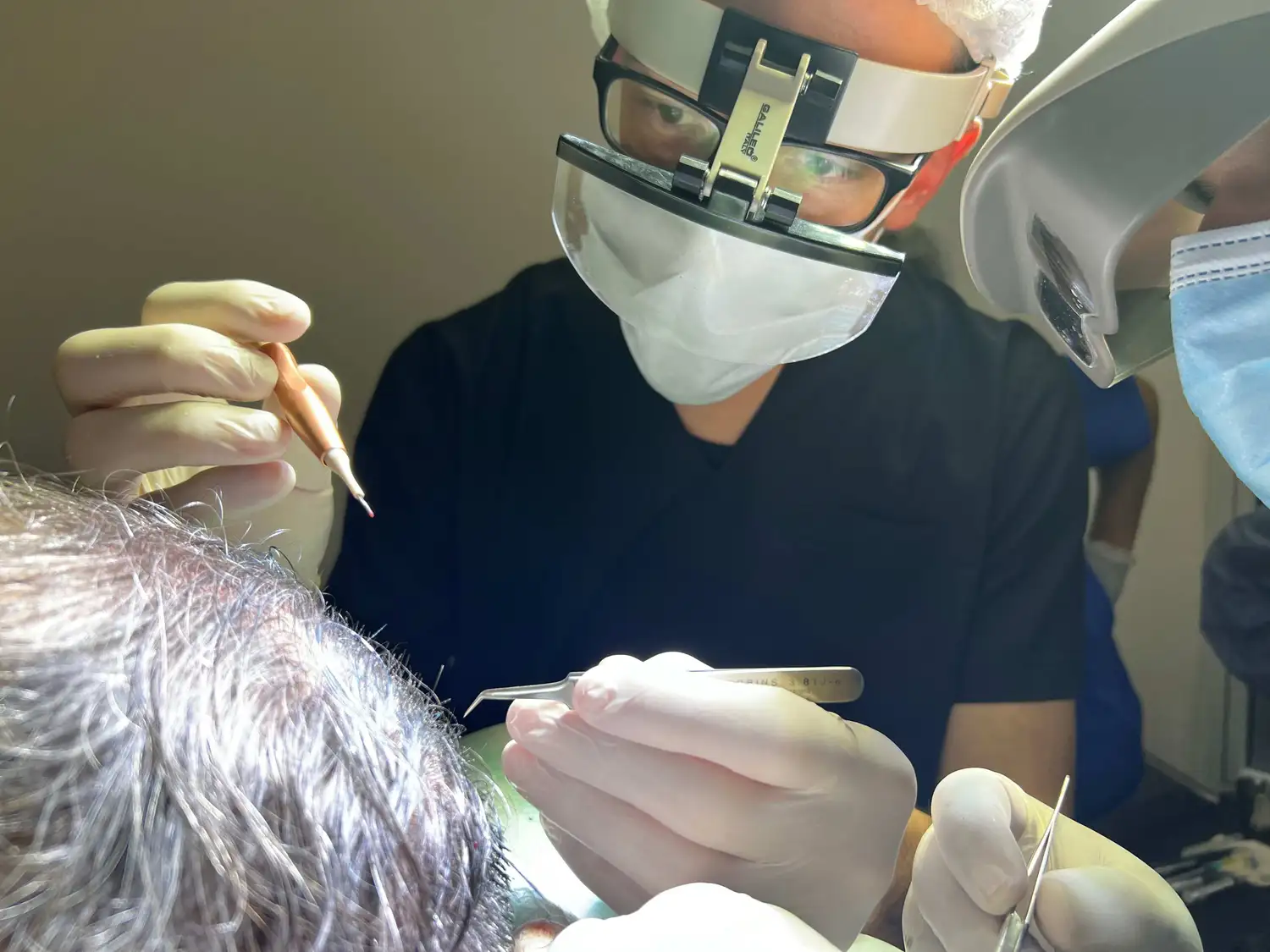 Medicina capilar y cirugía pelo por pelo