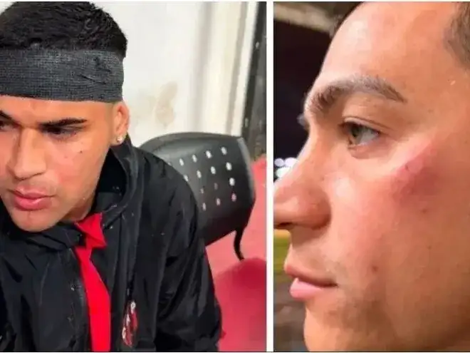 jugadores de patronato golpeados