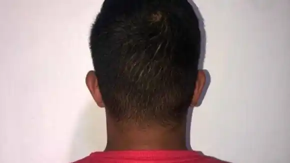 ¡Cuando se creía haberlo visto todo!: USABA MÁSCARAS PARA ROBAR MOTOS