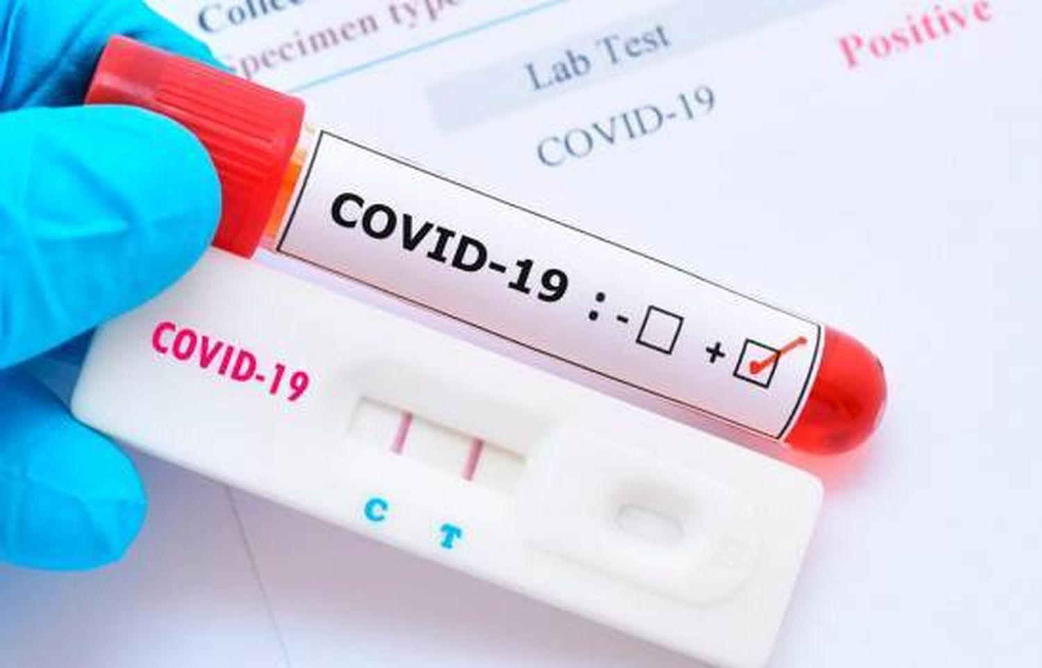 Concordia registro 67 nuevos casos de coronavirus