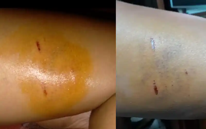 Perros sueltos: una adolescente fue atacada cuando iba a la escuela