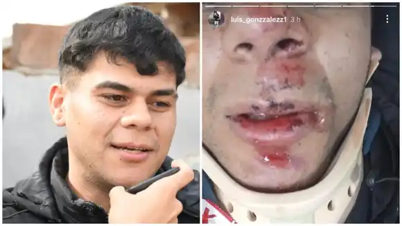 En Bahía Blanca lo conocen como el “Rey de las Picadas” y terminó internado tras chocar con un auto a gran velocidad