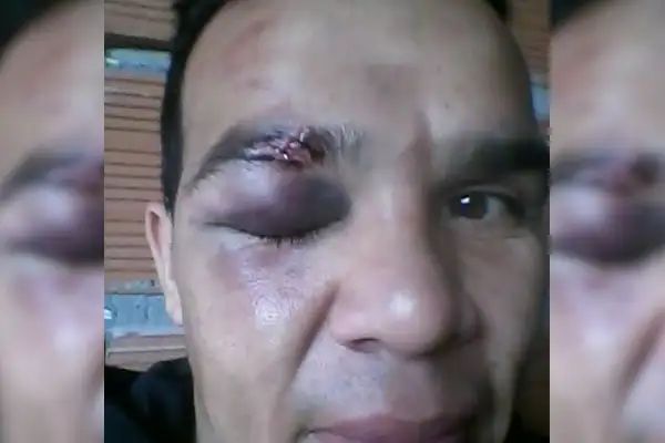 Como en la vida: "Te caes, te levantas, das batalla, pero nunca te das por vencido"   