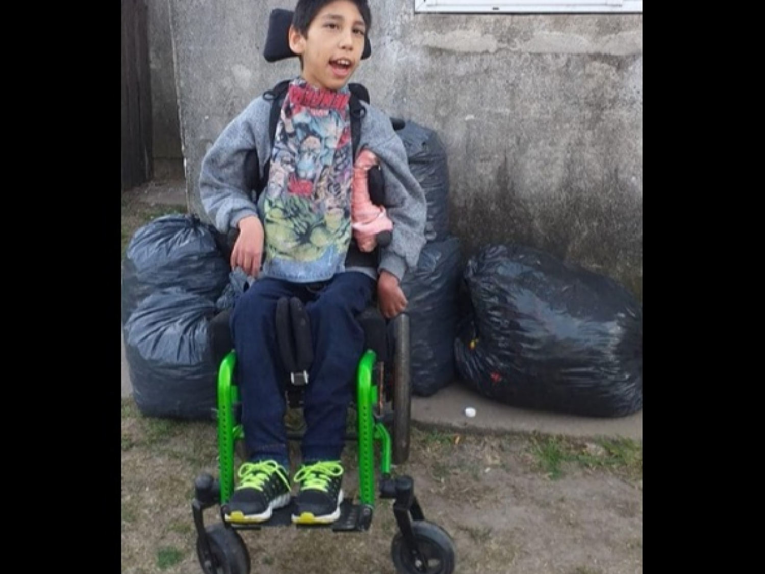"Todos x Jonatan": campaña de 5000 padrinos para ayudar al pequeño de San Jorge
