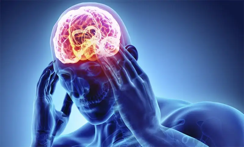 La epilepsia es un padecimiento cerebral crónico que en todo el mundo afecta a unos 50 millones de personas.