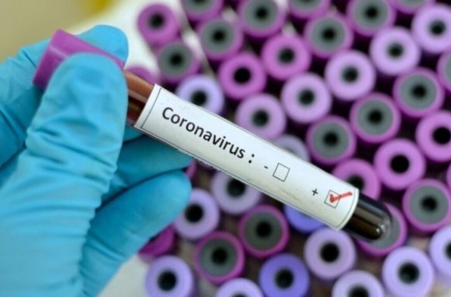 Hay 3.604 nuevos casos de coronavirus en el país y 40 muertes más