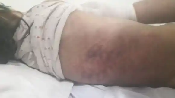 LE DESPRENDIÓ EL CORAZÓN: hombre mató a golpes a su hijastra de 1 año y 4 meses por defecar sobre él