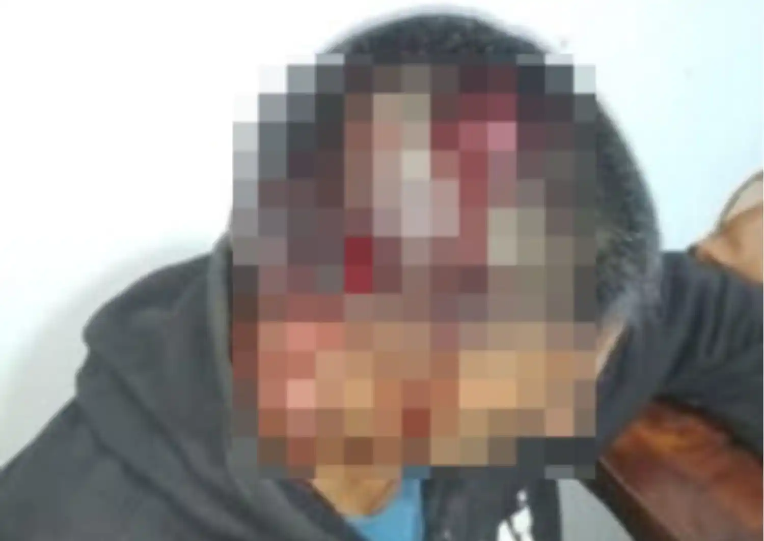 hombre herido en la tosquera