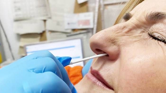 El 70% de las personas con covid persistente  tienen problemas de memoria meses después