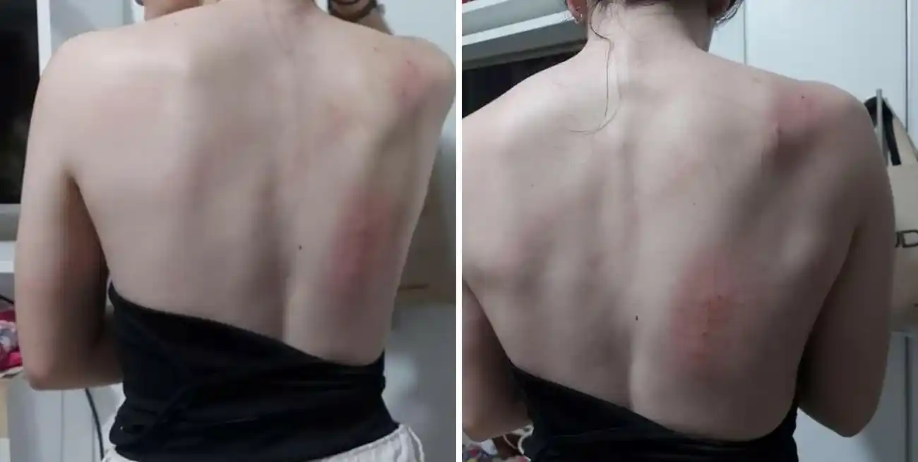 La menor resultó con lesiones por raspaduras en la espalda y piernas.