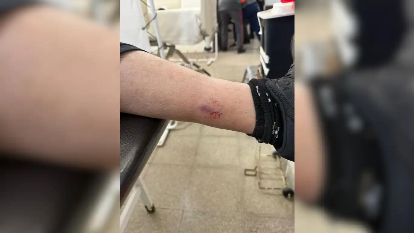 El coordinador de la Guardia Urbana sufrió una mordedura en su pierna izquierda.