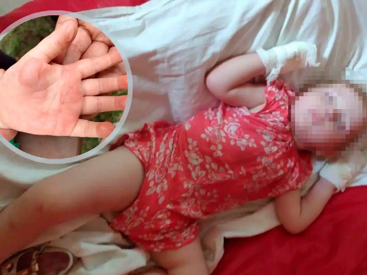 Una nena de Freyre también fue víctima del "puente ardiente" de Carlos Paz