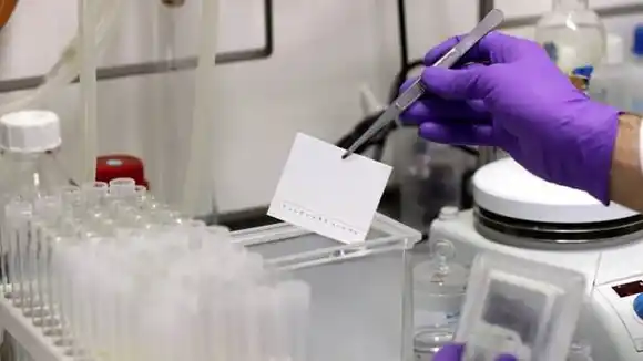 LABORATORIOS EN CRISIS: bioanalistas alertan que 89% no están operativos