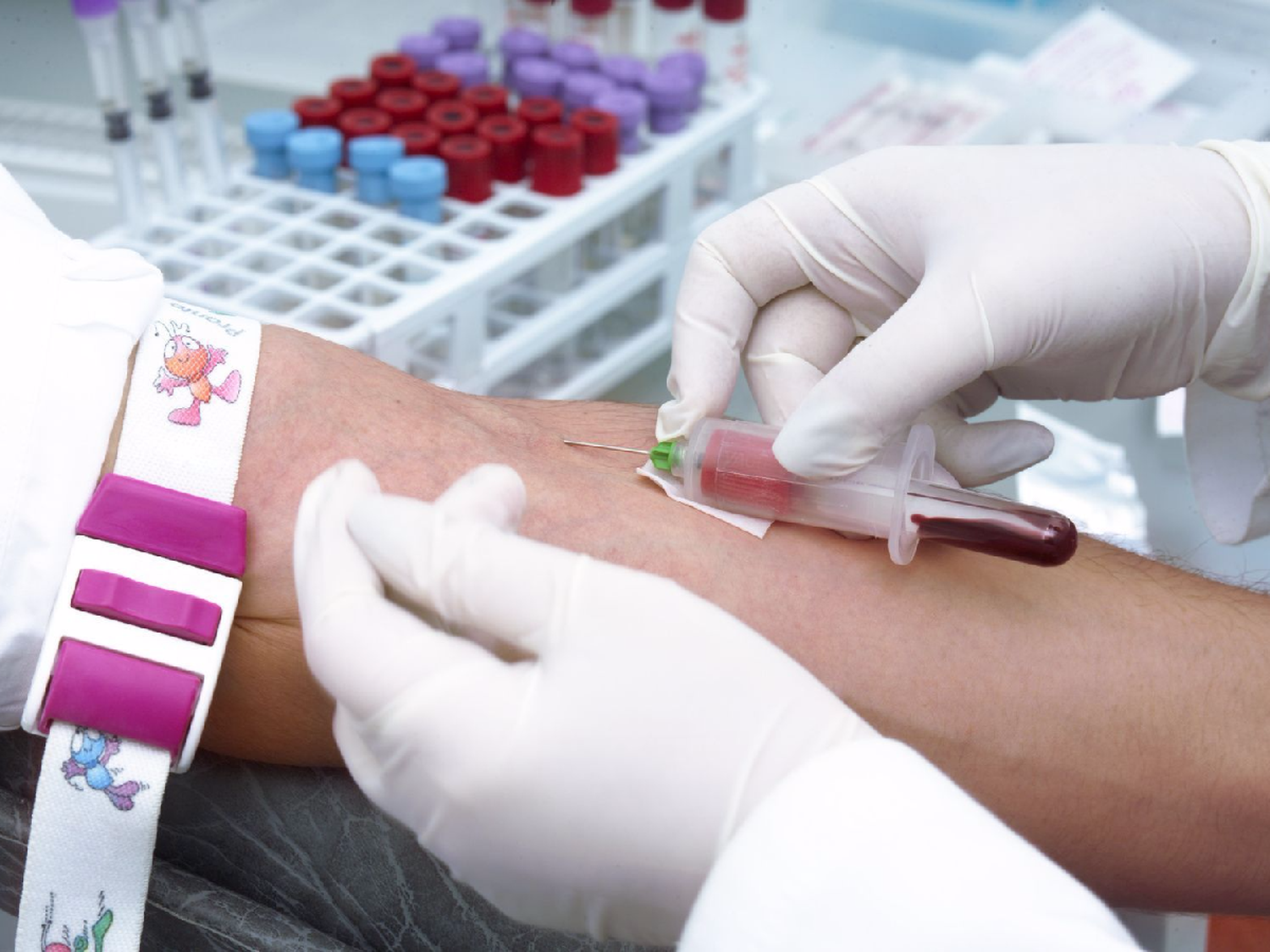 Cómo es el análisis PSA que ayuda a diagnosticar el cáncer de próstata