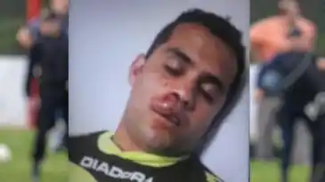 Brutal agresión a árbitro que suspendió un partido de liga regional