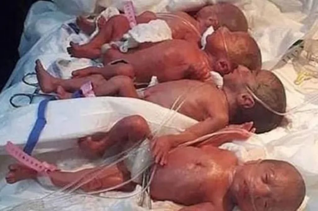 Sorpresa: una mujer dio a luz a nueve bebés