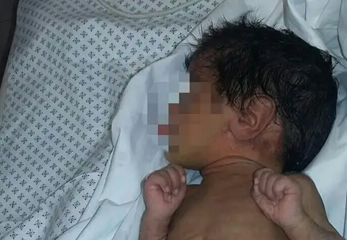 Un perro encontró a un bebé de 28 días abandonado en la calle
