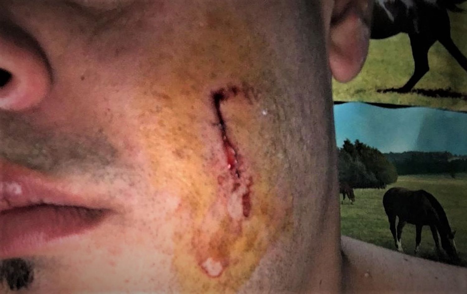 Bajó de la moto, intentó apuñalarlo y lo cortó en la cara: todo porque “lo miró” al pasar por la calle