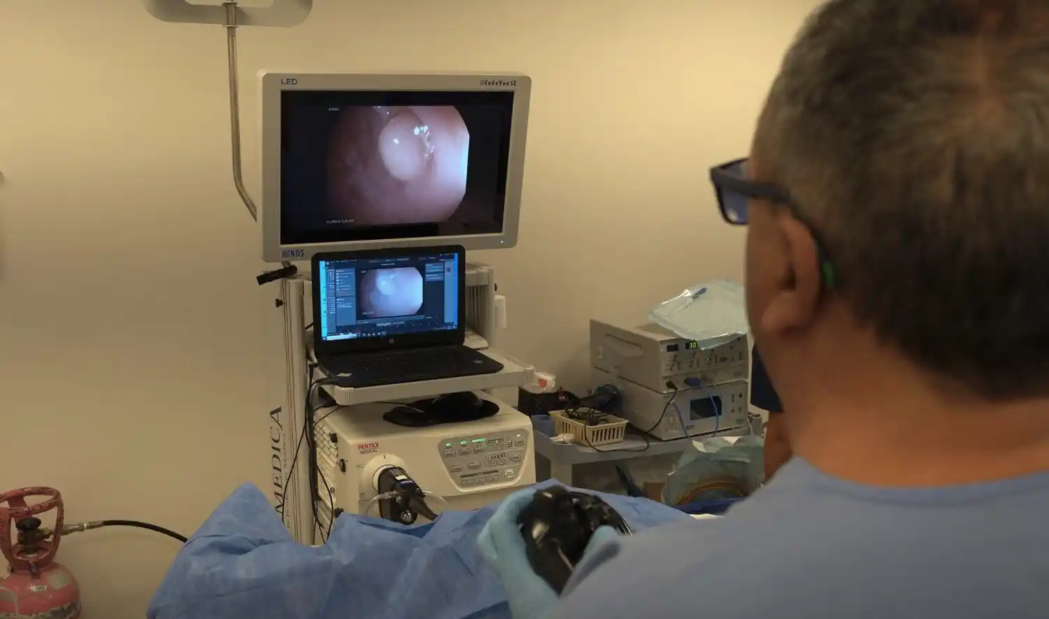 El doctor aconsejó estudiar sistemáticamente el colon “a partir de los 45 años”.