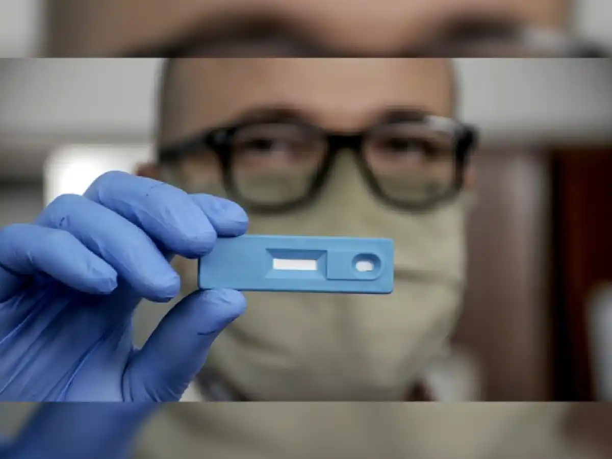 El test serológico rápido fue aprobado por Anmat y podrá encontrarse en  las farmacias en breve
