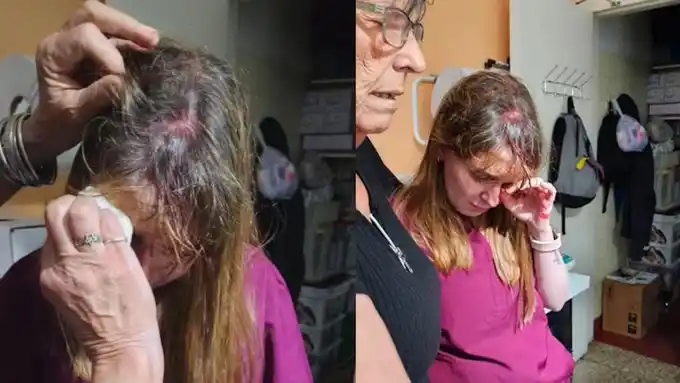 El ataque ocurrió cuando la agresora llegó al lugar para reclamar tras la muerte de las crías de su coneja.