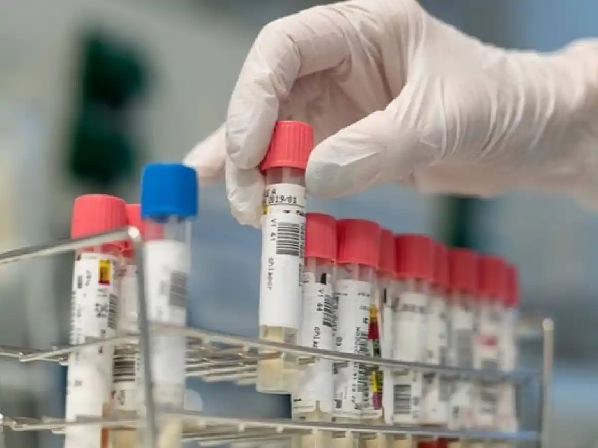 Con 244 nuevos casos, hay 6.278 contagiados y 314 muertes