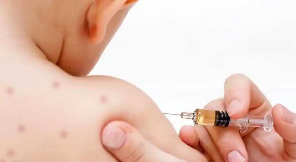 Ante la alarmante prevalencia del Sarampión, el Colegio de Médicos reclamó “urgentes campañas de promoción de la vacunación”