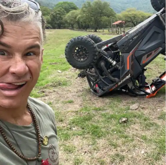 Fernando Carrillo tuvo chance de bromear sobre cómo quedo el rústico. Foto: Instagram