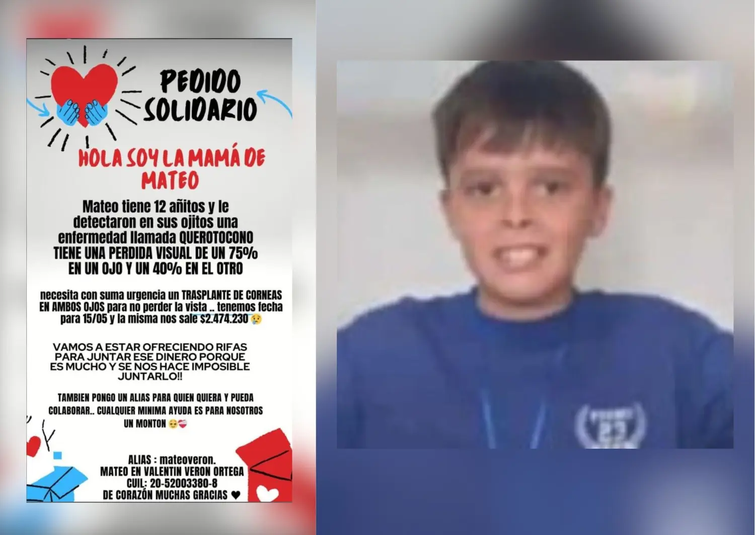 Mateo tiene 12 años y padece  queratocono.