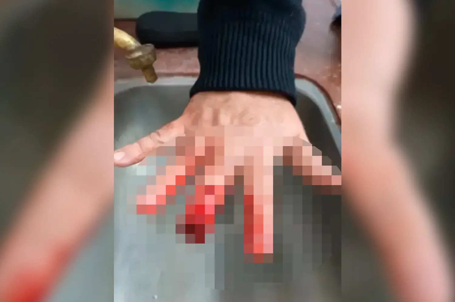 IMÁGENES SENSIBLES | Un policía perdió parte de un dedo tras ser mordido durante un forcejeo en Chaco