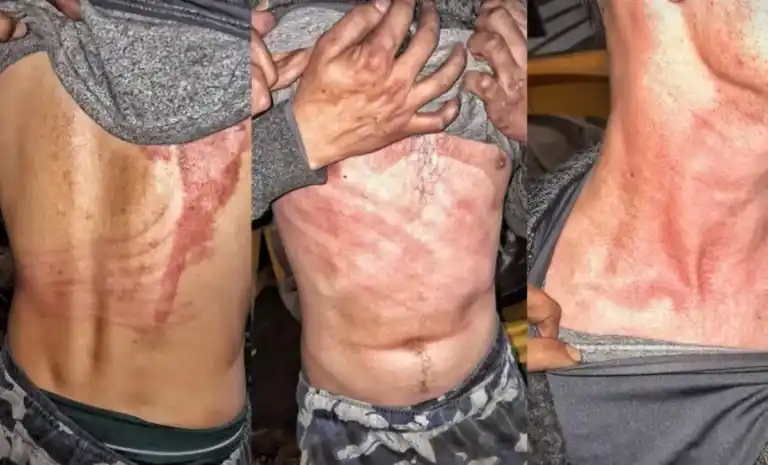 El jornalero mostró las lesiones que, según jura, le fueron infligidas por una entidad paranormal.