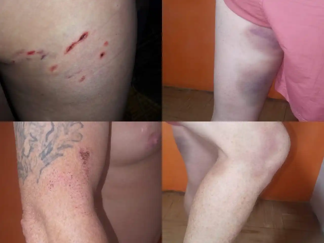 El relato de las víctimas de perros en Novillo, entre Salta y Pellegrini: “Alguien tiene que hacer algo”