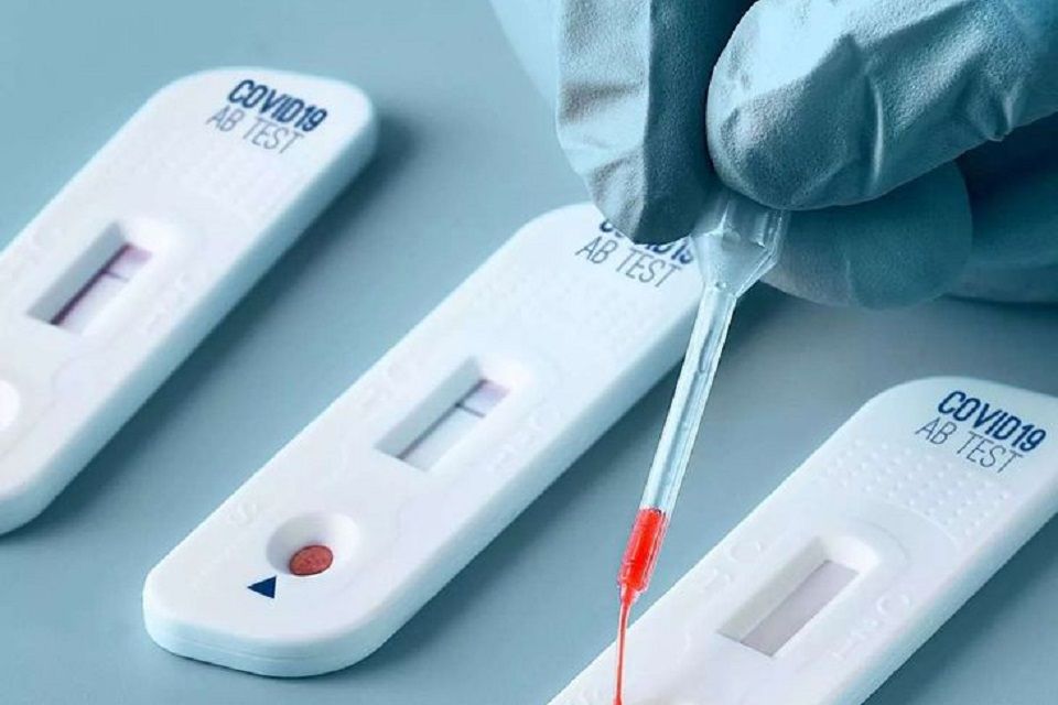 Los casos de Covid bajaron un 50 %