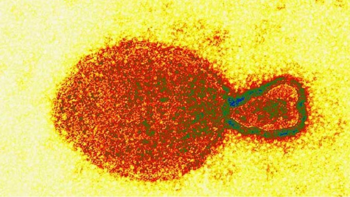 Alerta: China detectó 35 personas infectadas con un nuevo virus de origen animal