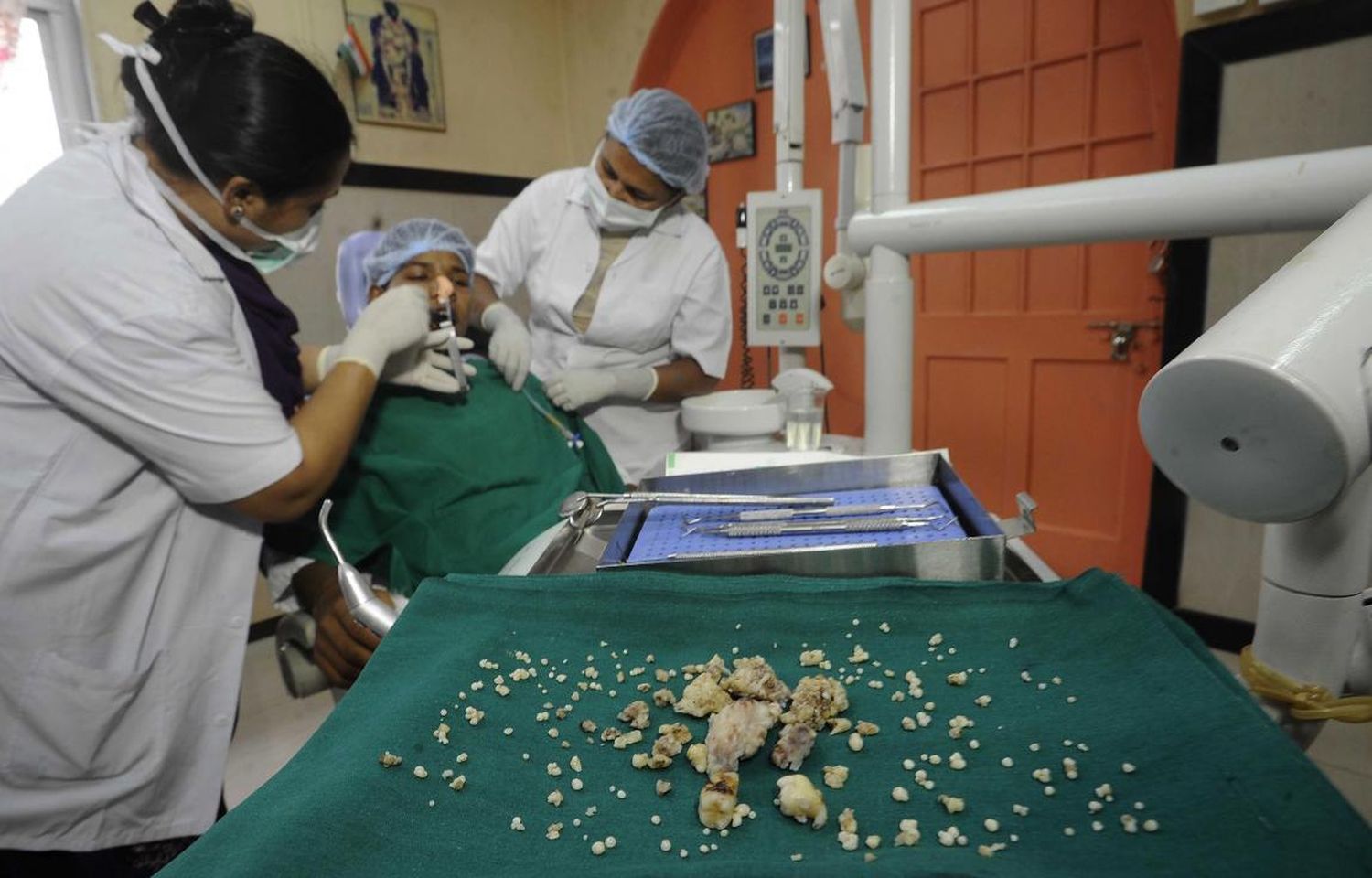 Record mundial: Extrajeron 232 dientes de la boca de un joven en la India