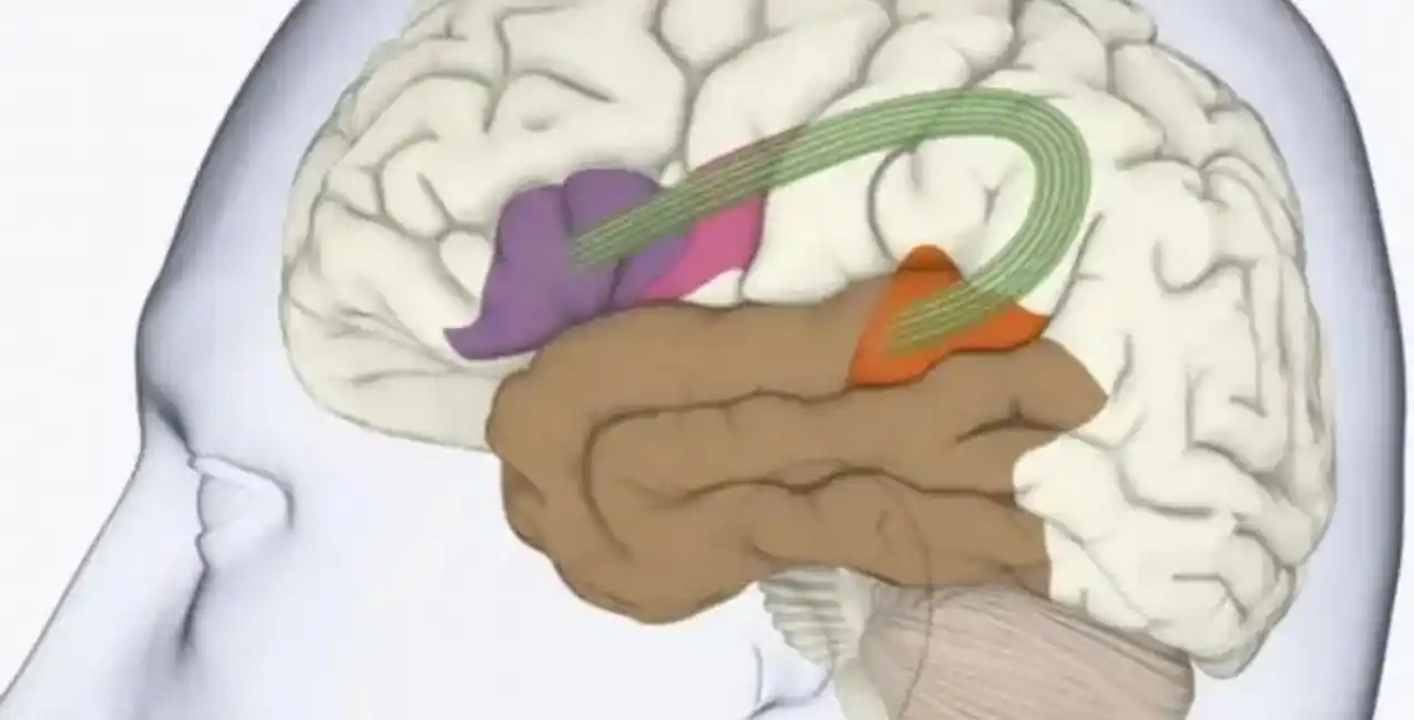 ¿Qué es la Afasia?, la enfermedad que sufre Bruce Willis