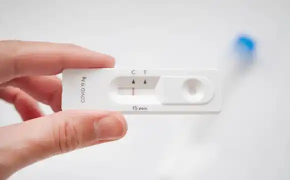 Todas las farmacias del país empezarán a vender los Autotest de covid