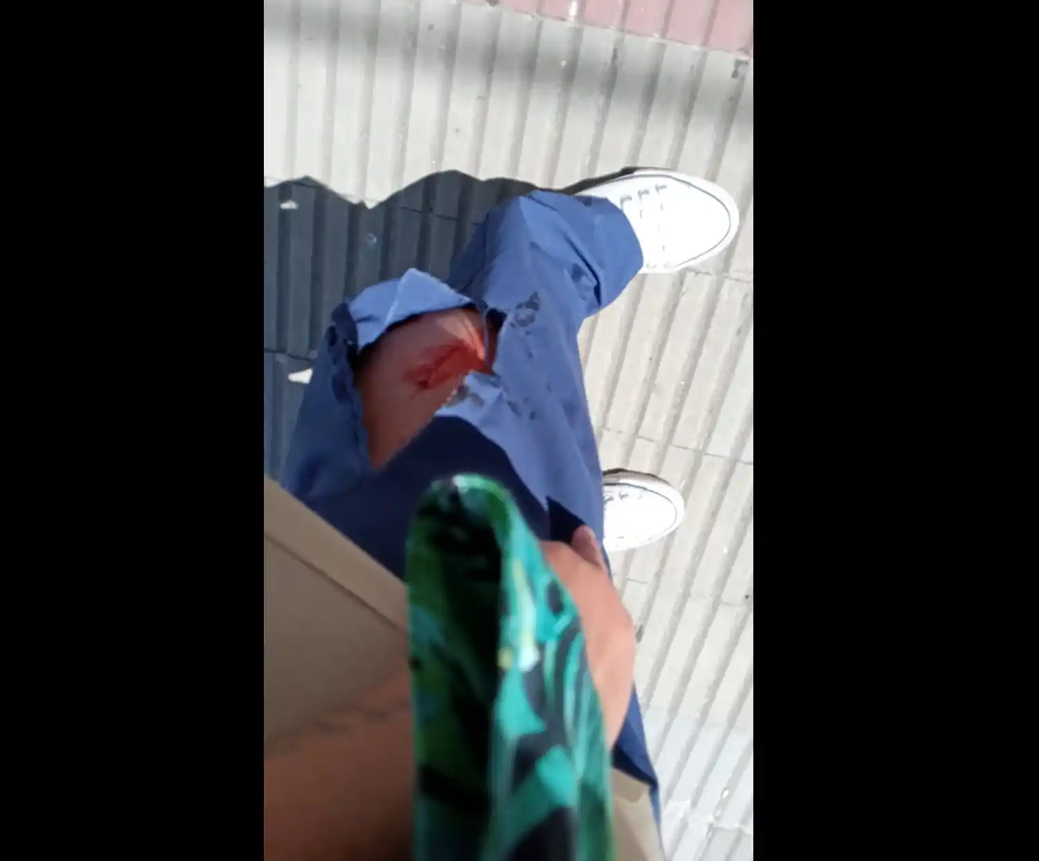 Perros atacaron a una mujer