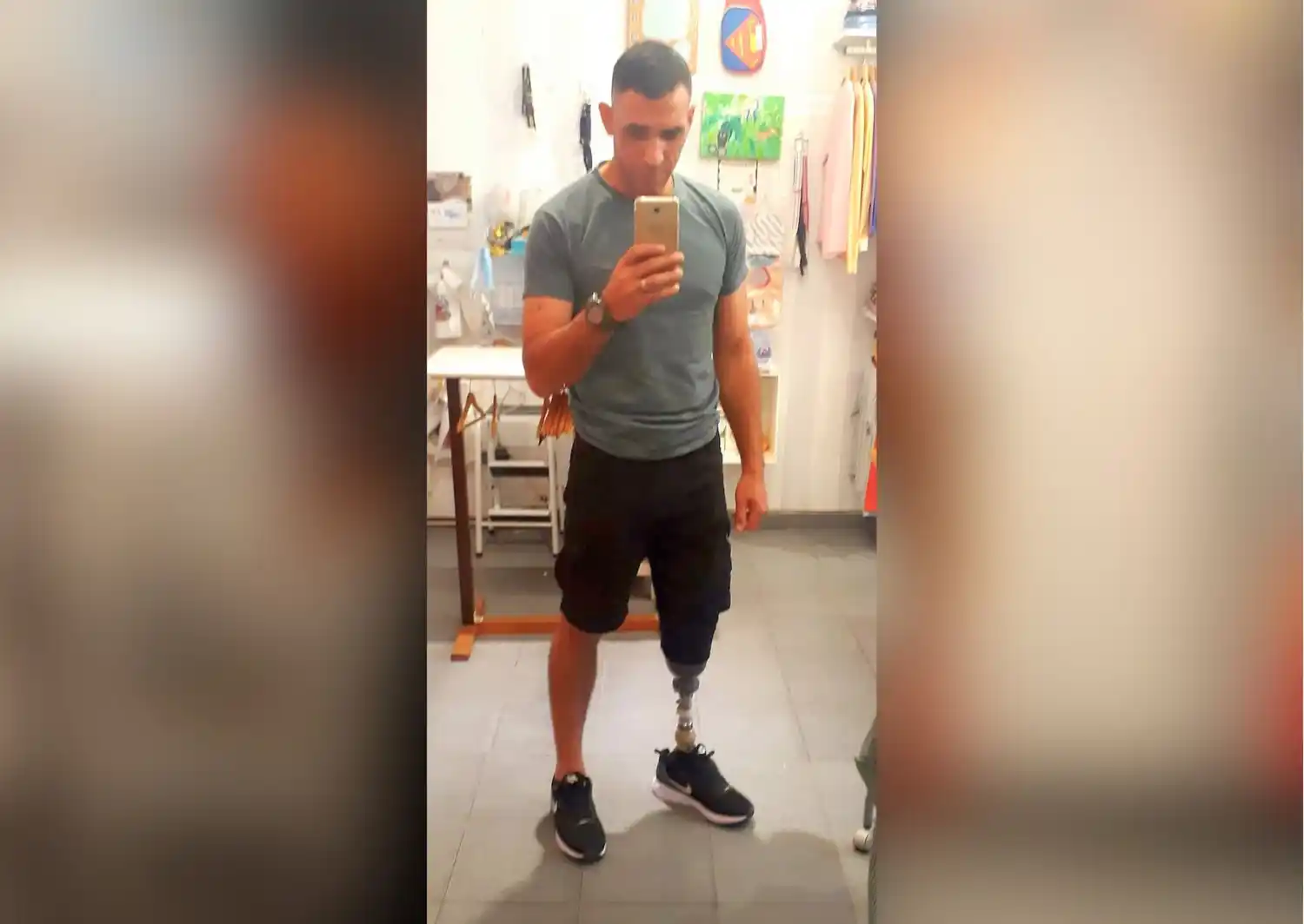 El hombre de 42 años pide colaboración a la gente para comprar una nueva prótesis.