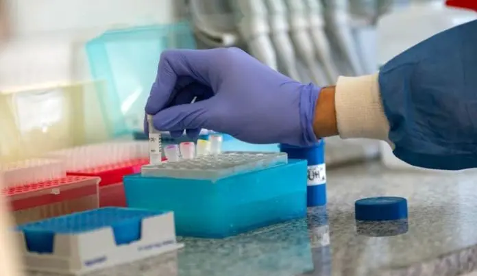 Coronavirus: 82 muertos y 4.250 nuevos contagios de coronavirus en 24 horas