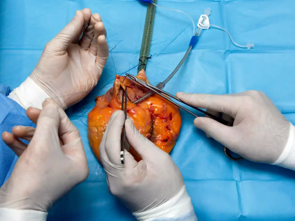 En el primer cuatrimestre del año se realizaron 155 trasplantes más que en el 2018