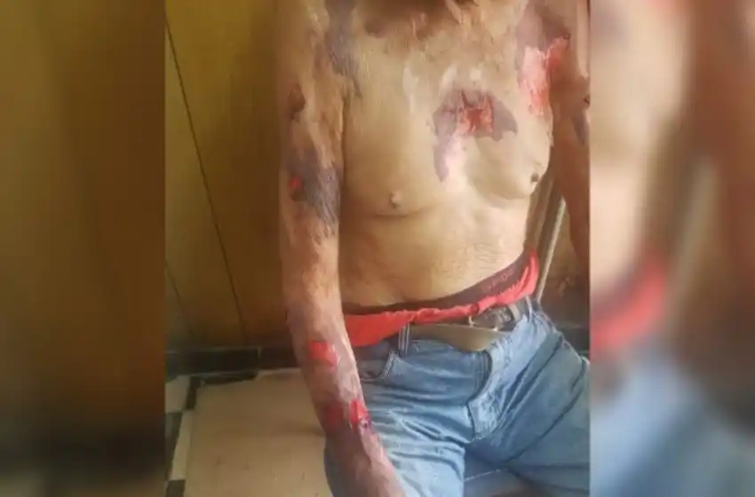 En un violento asalto le robaron 150 mil pesos a un hombre de 91 años