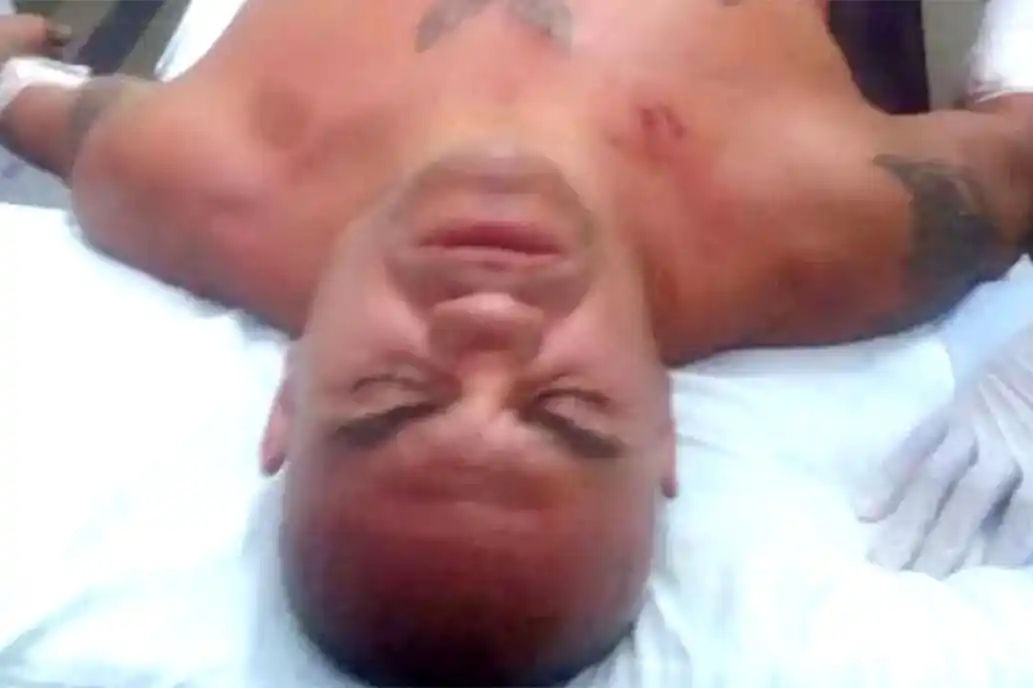Detuvieron al agresor de Jorge «La Hiena» Barrios