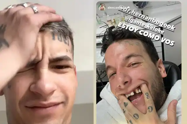 Alex Caniggia mostró fotos de sus dientes reales y se comparó con L-Gante: “Estoy como vos”