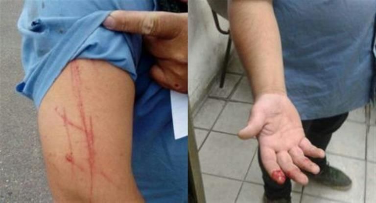 Otro ataque a un colectivero: Ahora acuchillaron a un chofer de la línea 169 en Podestá