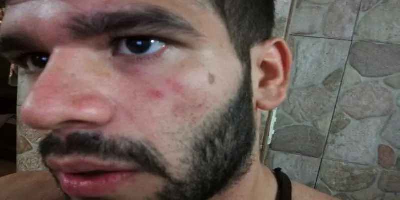 Periodista fue golpeado frente a funcionarios de la PNB en la Baralt