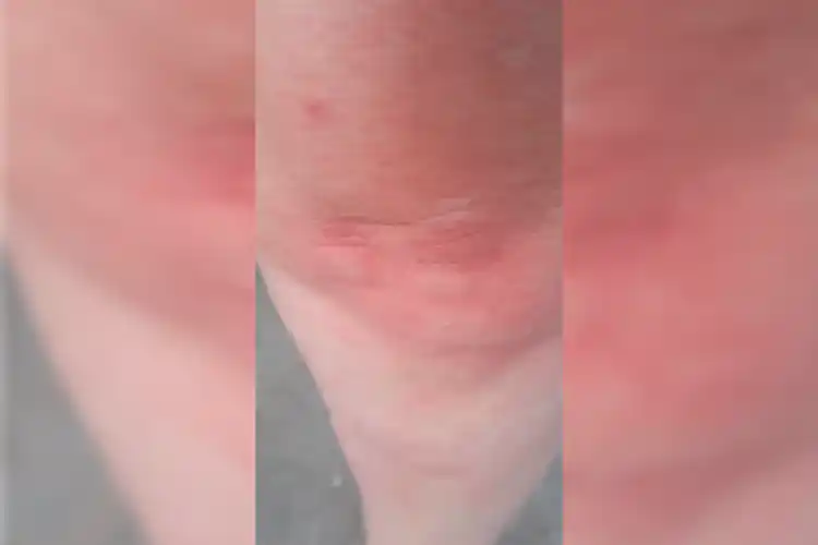 Vuelta de Obligado: preocupación por “invasión de mosquitos y jejenes”