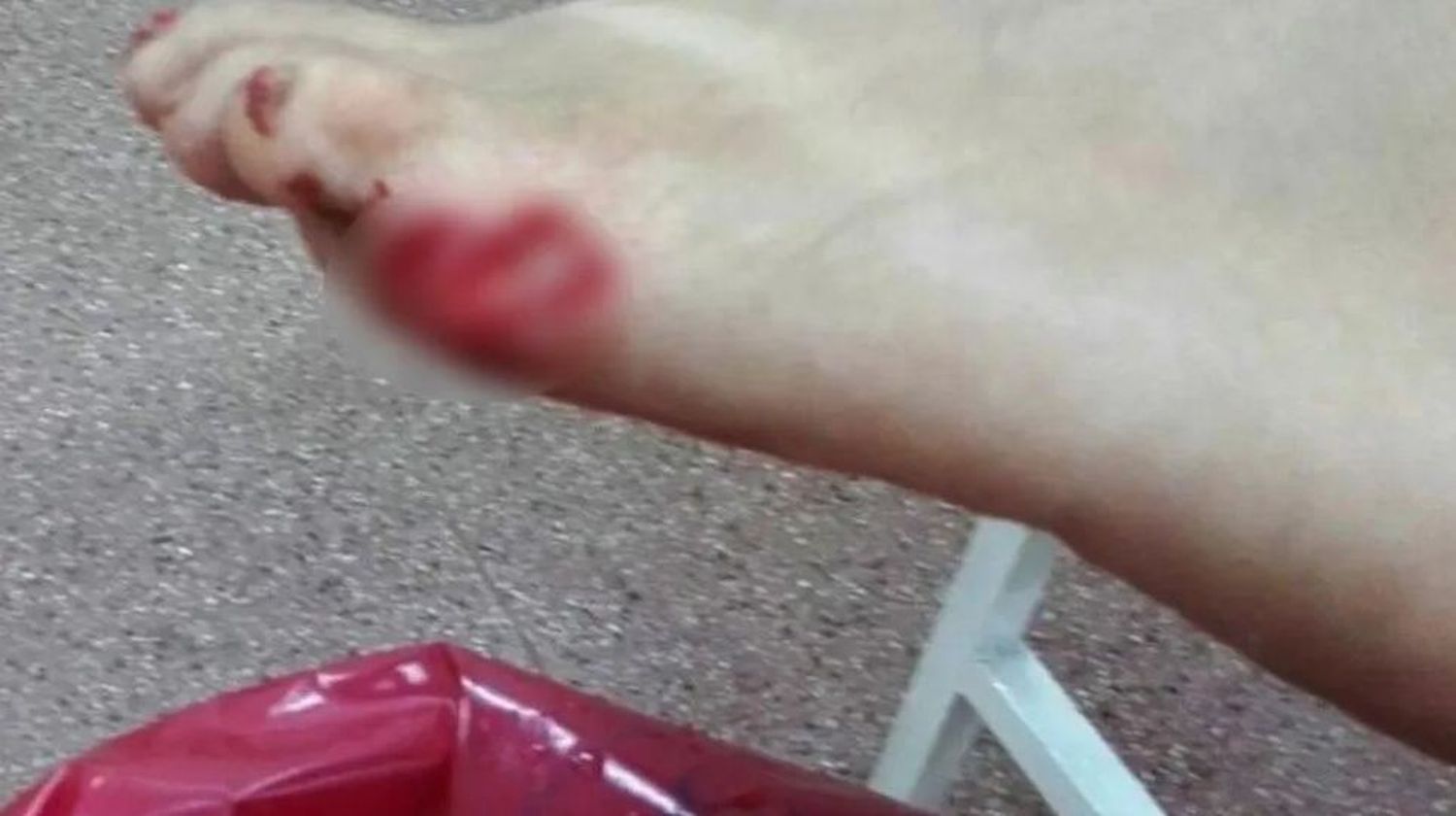 Reportan más de una docena de ataques de pirañas en una playas del río Paraná