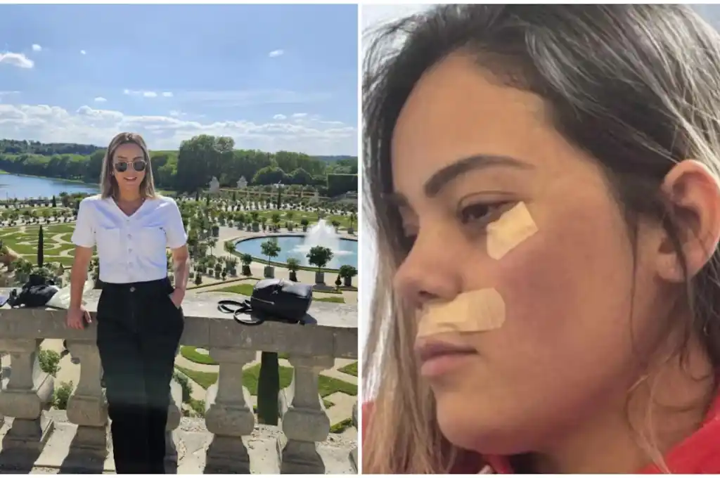 agredida tren parís 4