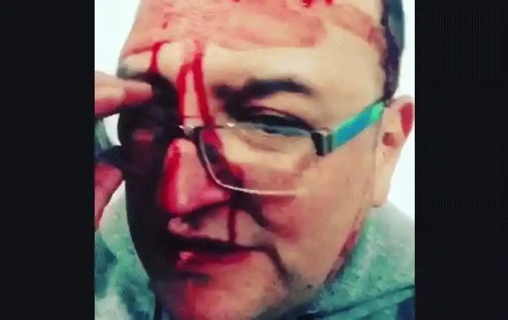 Golpiza a Leo García: La justicia pone en duda la versión sobre un “ataque homofóbico”